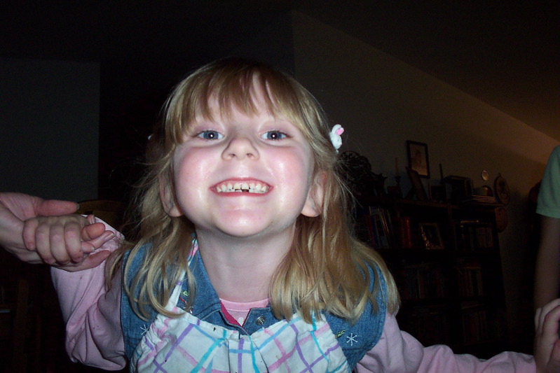 Missing a tooth